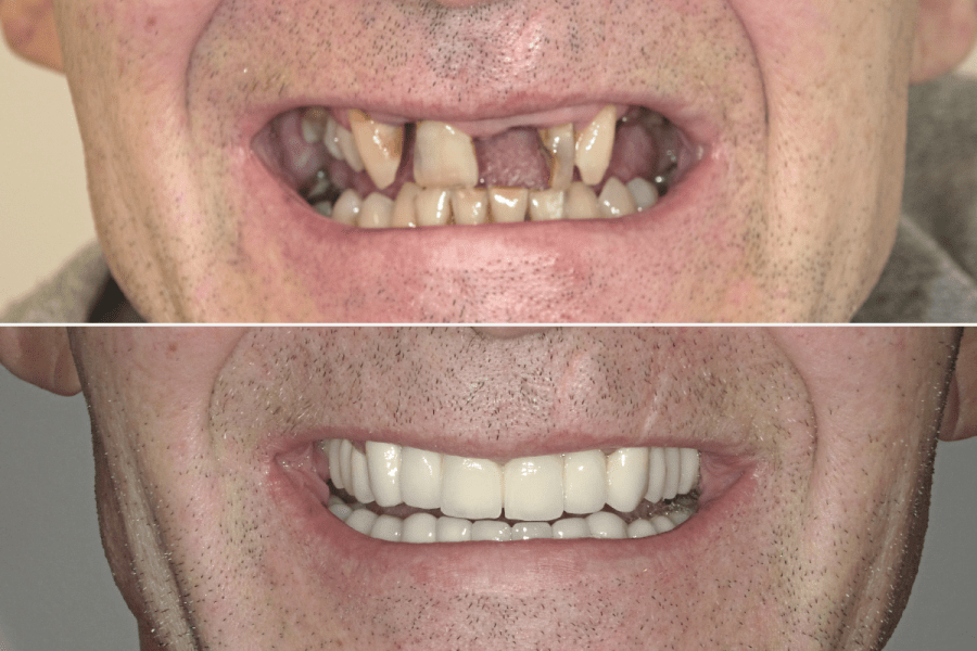 VIDEO: Pogledajte nevjerojatnu promjenu osmijeha u zagrebačkom dentalnom centru