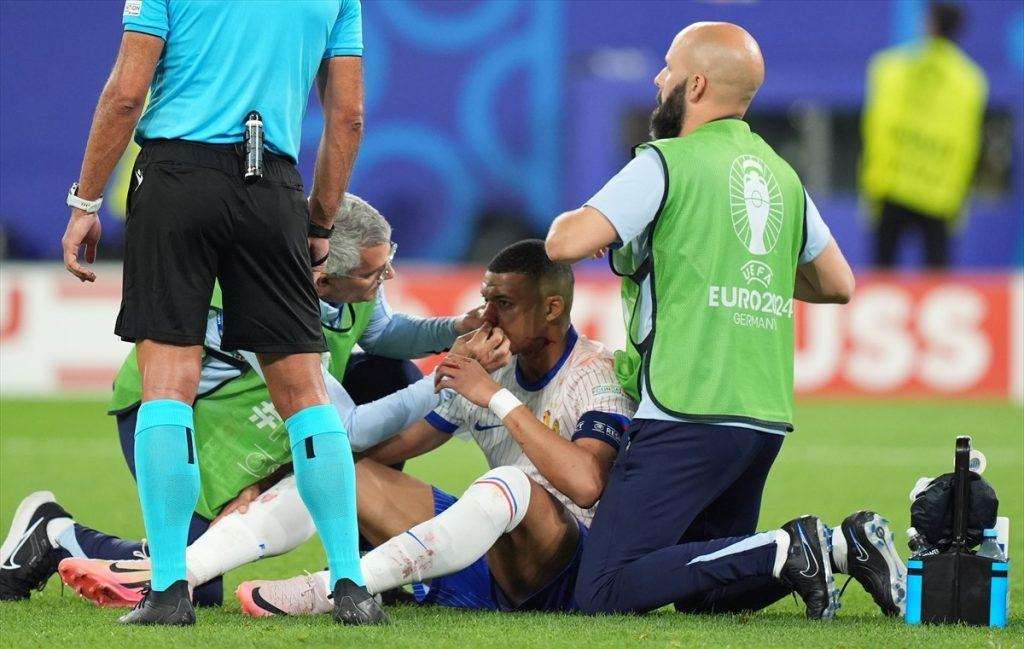 Mbappe je glavom udario u rame austrijskog igrača Dansa pri čemu je slomio nos / Foto: Anadolu