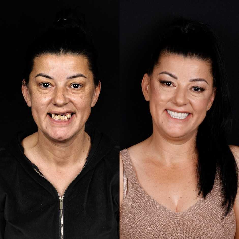 STOMATOLOŠKA POLIKLINIKA SALONA DENTAL: Centar vrhunske stomatologije u Dalmaciji STOMATOLOŠKA POLIKLINIKA SALONA DENTAL: Centar vrhunske stomatologije u Dalmaciji