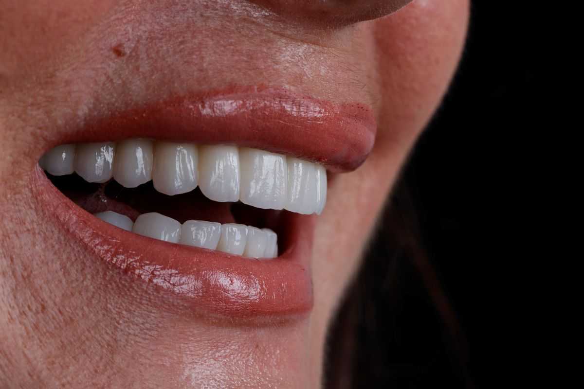 STOMATOLOŠKA POLIKLINIKA SALONA DENTAL: Centar vrhunske stomatologije u Dalmaciji STOMATOLOŠKA POLIKLINIKA SALONA DENTAL: Centar vrhunske stomatologije u Dalmaciji
